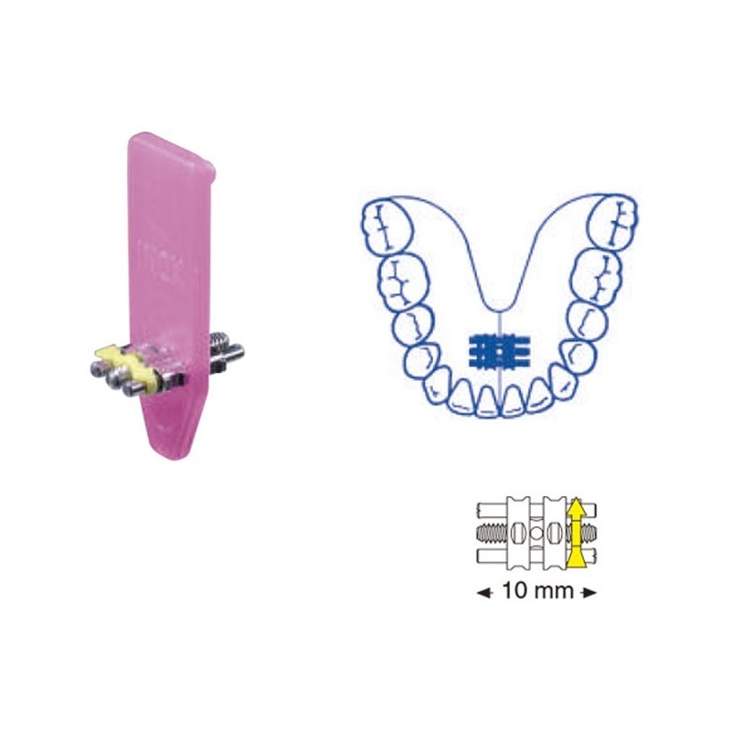 VIS EXPANSIÓN UNIVERSELLE 10 mm 10 Unites