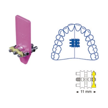 VIS EXPANSIÓN POUR SUPERIEURES 11 mm 10 Unites