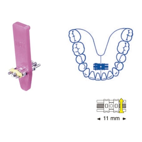VIS EXPANSIÓN SUPER MICRO 11 mm 10 Unites