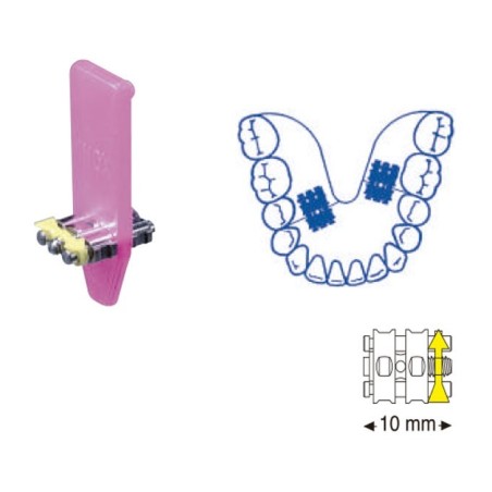 VIS EXPANSIÓN MICRO MONOLATERAL 10 mm 10 Unites