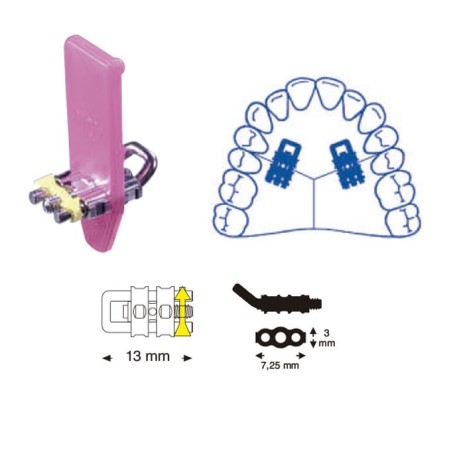 VIS EXPANSIÓN MICRO MONOLATERAL GUIDE U DOBLADA 13 mm 10 Unites