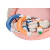 GARRISON MATRIES COMPOSÍ-TIGHT 3D REPOSITION