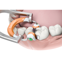 GARRISON MATRIES COMPOSÍ-TIGHT 3D REPOSITION