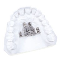 EXPANSOR PALATAL POUR TADS 10 mm