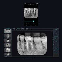 SCANNER DE PLAQUE PHOSPHORE I-SCAN