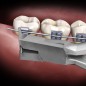 PINCE COUPE DISTAL SLIM