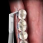 PINCE COUPE DISTAL SLIM