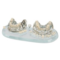 REPUESTOS MODELE ESTUDIO DEMOSTRACION IMPLANT CplusB