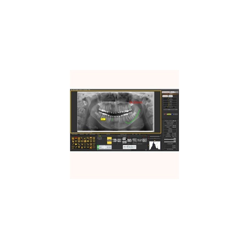 SOFTWARE IMAGERIE DENTAIRE MEDIADENT MULTI USER USB